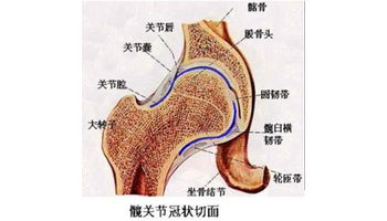 发病的股骨头坏死持续骨折脱位的颈部或臀部干扰流通.